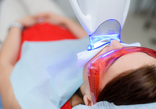 Lade das Bild in den Galerie-Viewer, Professional Zahnbleaching